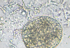 食品安全标准中铜绿假单胞菌解读